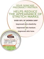 ⁦بالمرز تامي باتر بتركيبة زبدة الكاكاو | العلاج المكثف لعلامات تمدد الجلد - 125 جم⁩ - الصورة ⁦2⁩